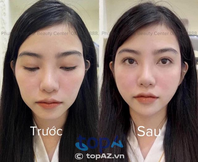 Địa chỉ vàng đào tạo kỹ thuật tiêm Filler - Botox chuẩn y khoa tại Hải Phòng