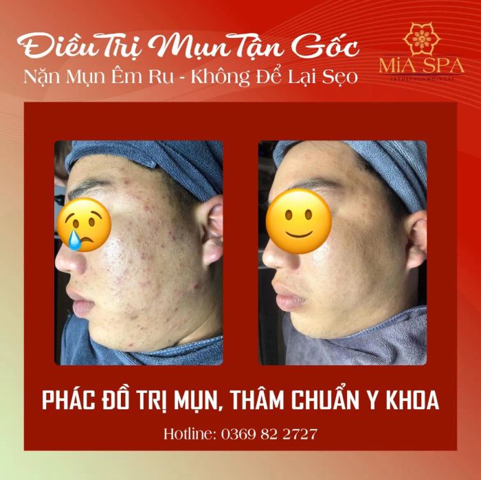 MiA Spa - Khoảnh khắc đẹp tựa nghệ thuật