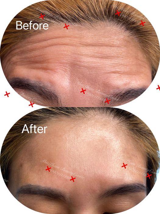Hình ảnh quy trình chăm sóc da chuyên nghiệp tại Miu Phạm Beauty Center