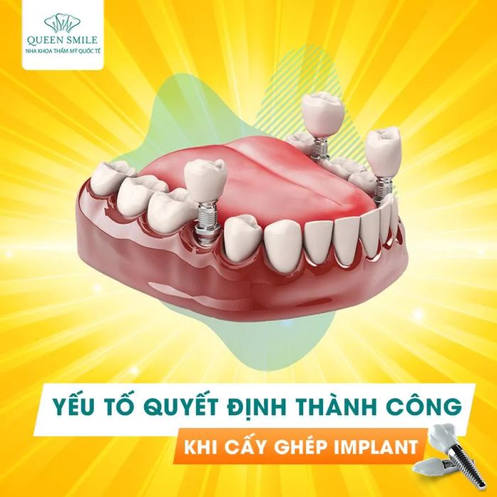 Hình ảnh thực tế về cơ sở vật chất hiện đại tại Nha khoa Queen Smile