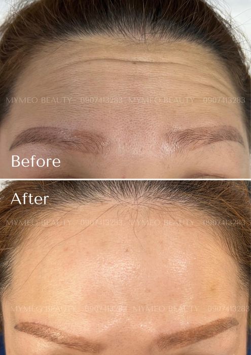 Hình ảnh quy trình điều trị da chuyên nghiệp tại My Meo Beauty Academy