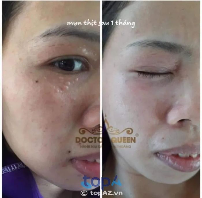 SOJO Beauty Center - Địa chỉ vàng chăm sóc da Quận 6