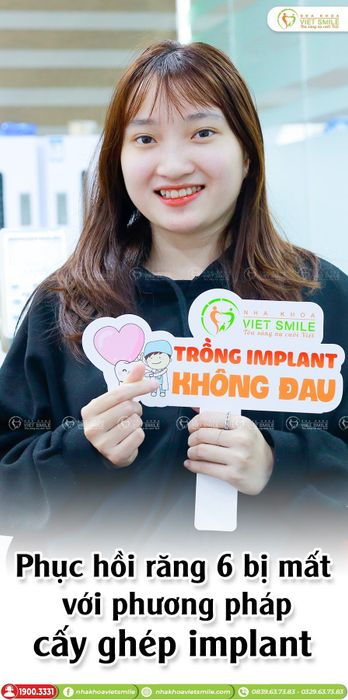 Hình ảnh quy trình cấy ghép Implant chuẩn quốc tế tại VIET SMILE