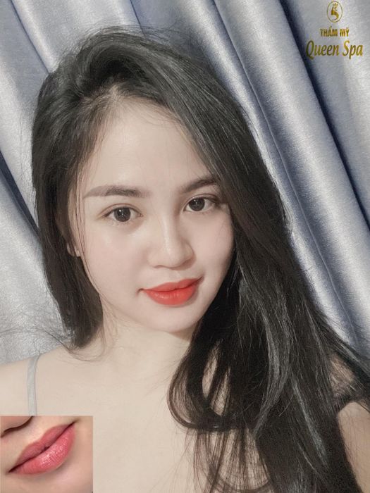 Thẩm Mỹ Queen Spa - Kiên Giang Ảnh 1