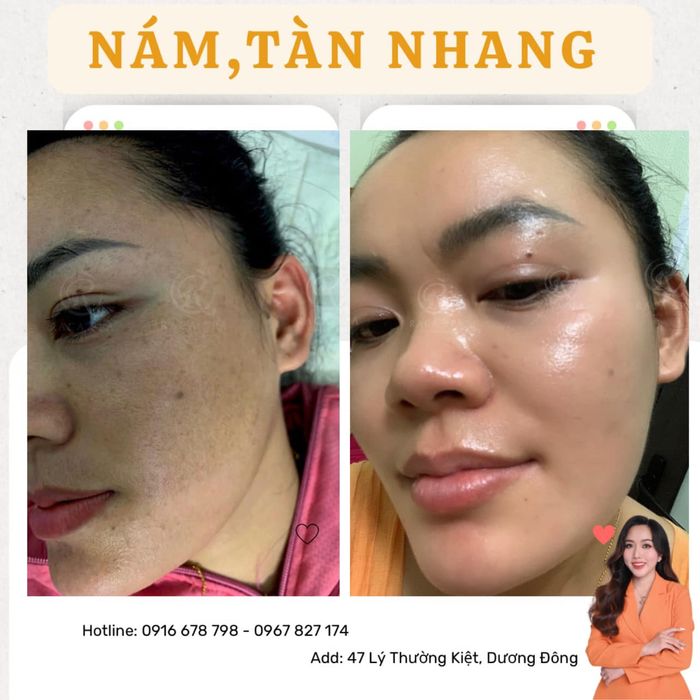 Không gian sang trọng và dịch vụ đẳng cấp tại Raca Spa