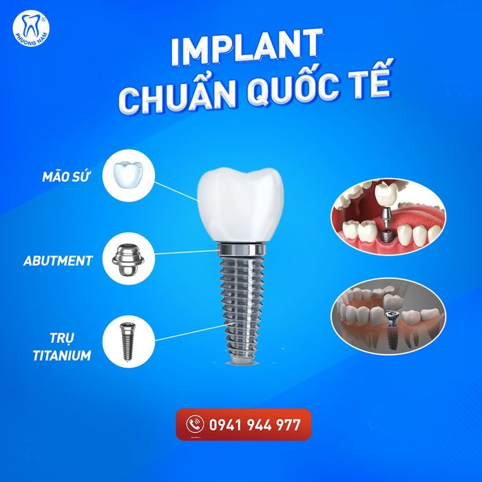 Hình ảnh cơ sở vật chất hiện đại tại Nha Khoa Phương Nam