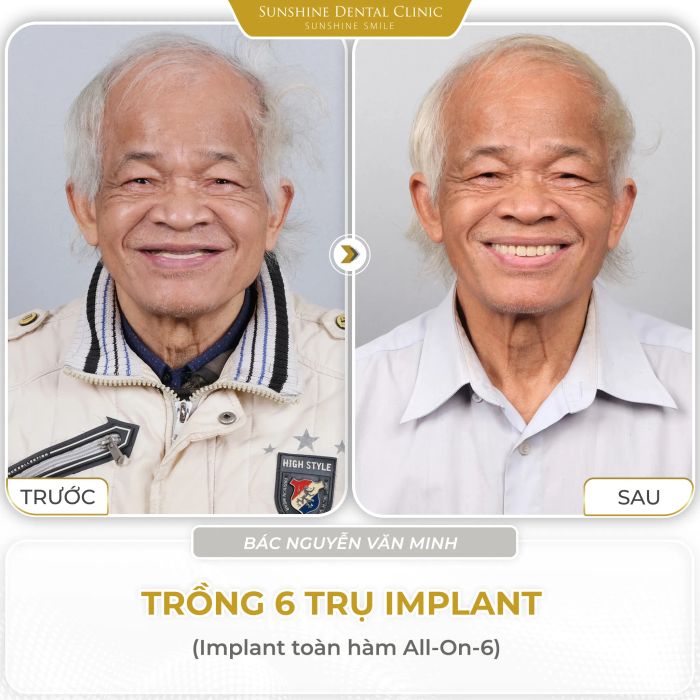 Hệ thống máy móc tân tiến tại Sunshine Dental Clinic