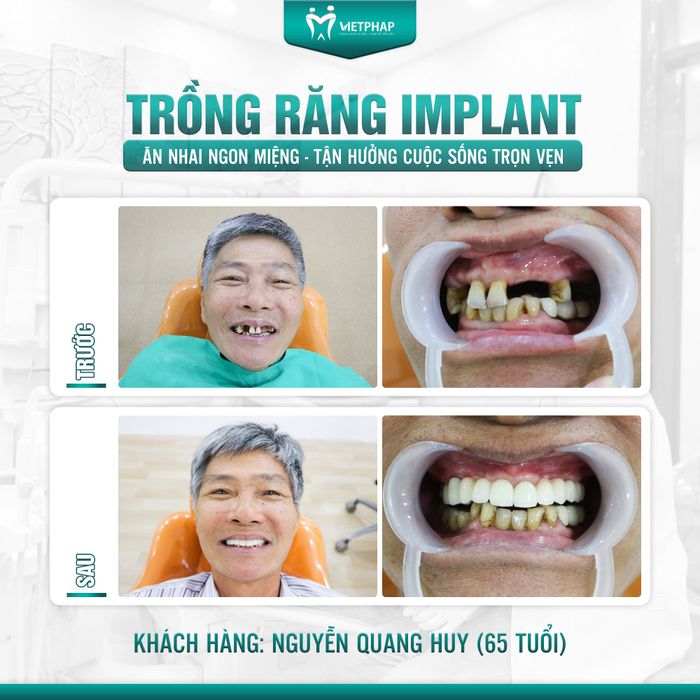 Hình ảnh đội ngũ bác sĩ chuyên môn tại Nha Khoa Quốc Tế Việt Pháp