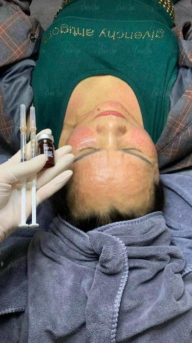 Hình ảnh quy trình chăm sóc da chuyên nghiệp tại Beden Spa