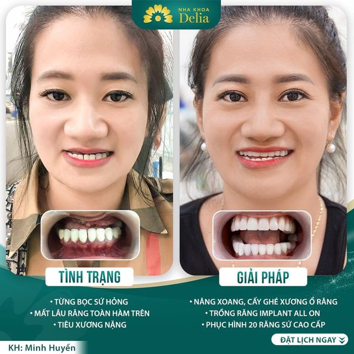 Nha Khoa Thẩm Mỹ Quốc Tế Delia Hình Ảnh 2
