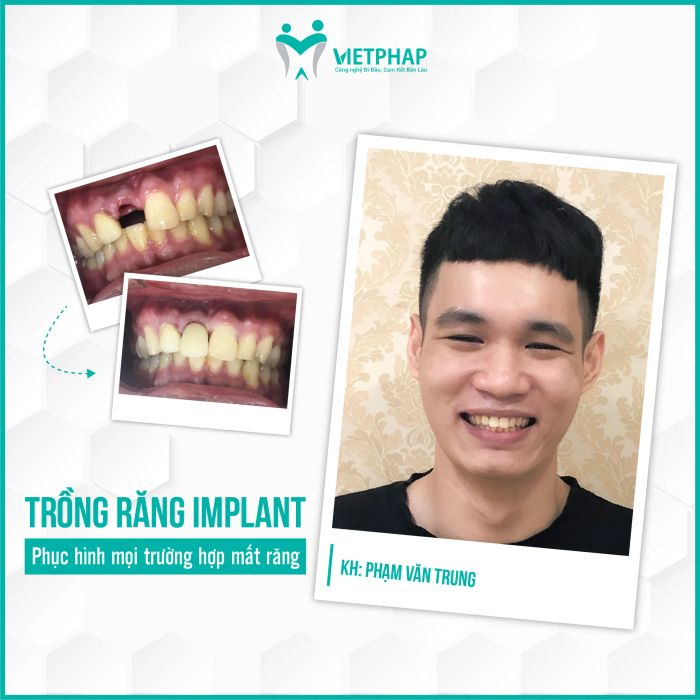 Không gian sang trọng đạt chuẩn Pháp tại Nha khoa Việt Pháp