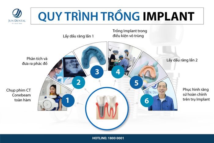 Hình ảnh thực tế Nha Khoa Thẩm Mỹ Quốc Tế Jun Dental