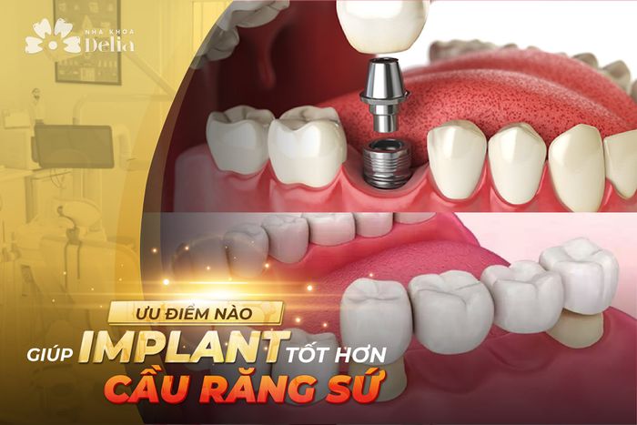 Nha Khoa Thẩm Mỹ Quốc Tế Delia Hình Ảnh 1