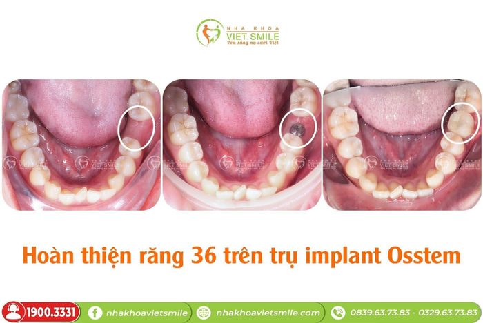 Hình ảnh cơ sở vật chất hiện đại tại Nha khoa VIET SMILE
