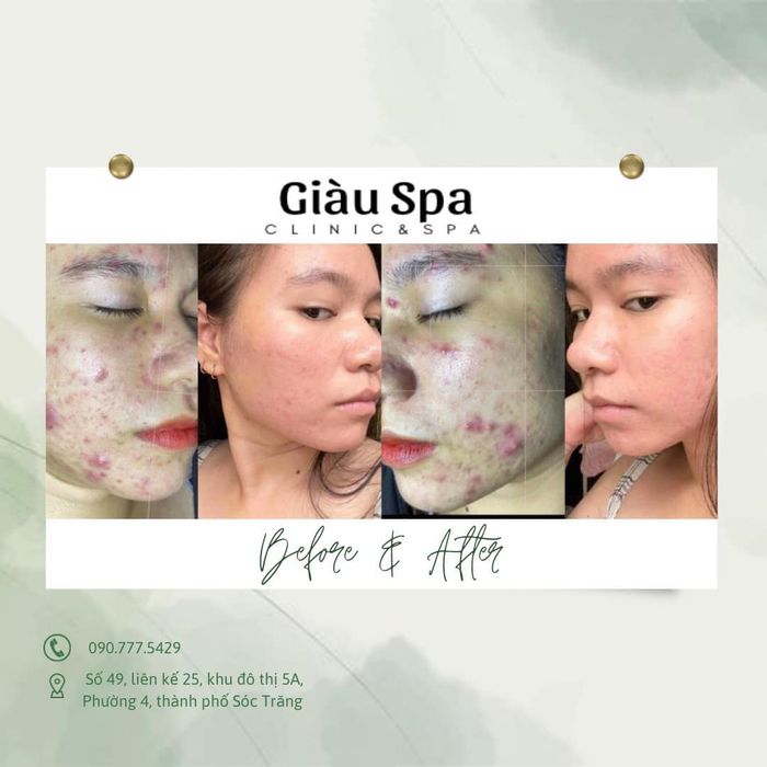 Hình ảnh Giàu Spa Sóc Trăng 1
