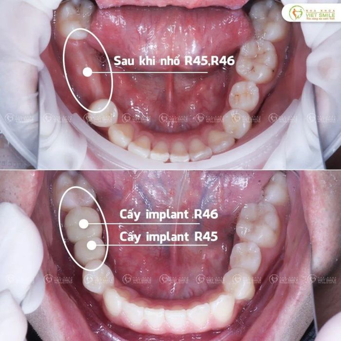 Hình ảnh thực tế Nha Khoa Thẩm Mỹ VIET SMILE - góc nhìn chân thực