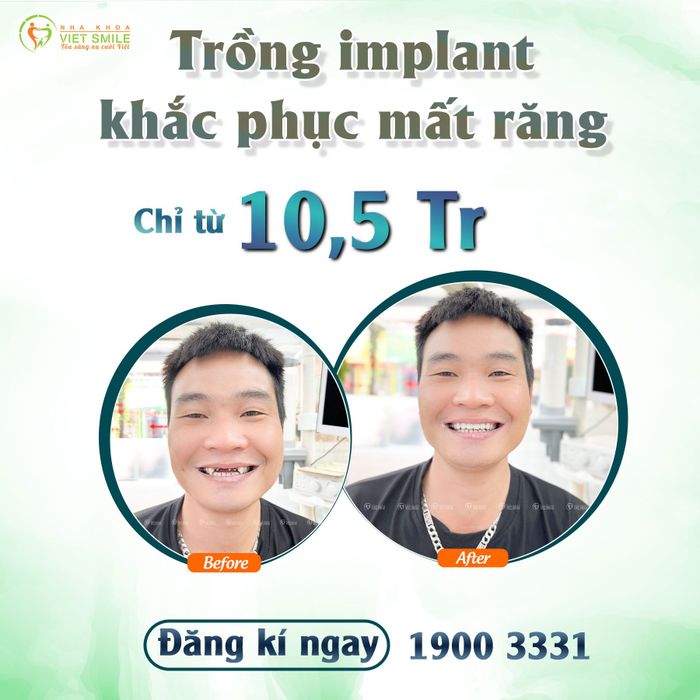 Hình ảnh không gian hiện đại tại Nha khoa VIET SMILE