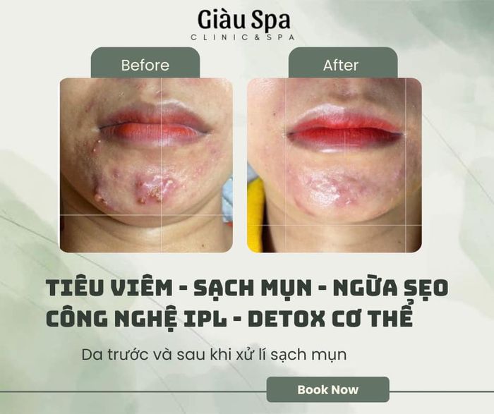 Hình ảnh Giàu Spa Sóc Trăng 2