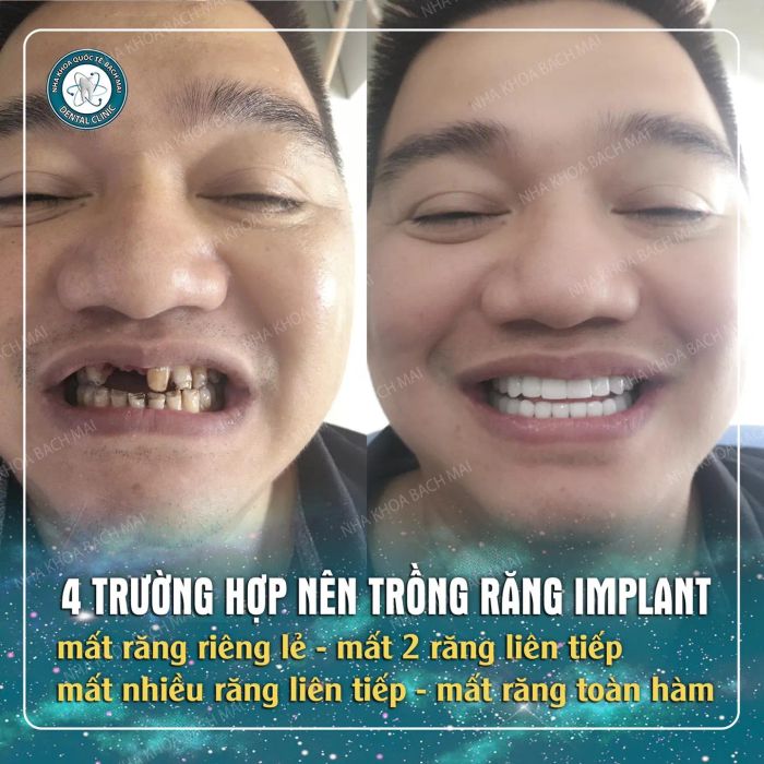Hệ thống phòng khám tiêu chuẩn quốc tế tại Bạch Mai Dental