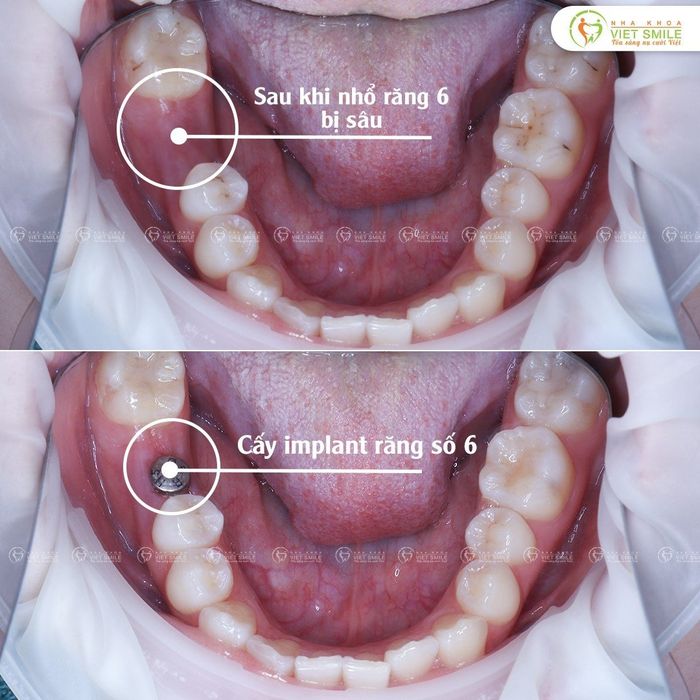 Không gian hiện đại đạt chuẩn quốc tế tại Nha khoa VIET SMILE
