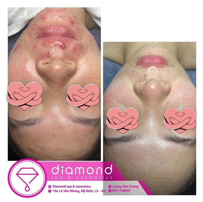 Không gian thư giãn đẳng cấp tại Diamond Spa & Cosmetics