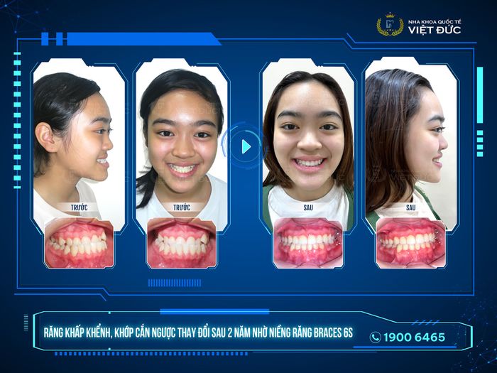 Hình ảnh thực tế về cơ sở vật chất hiện đại tại Nha Khoa Quốc Tế Việt Đức