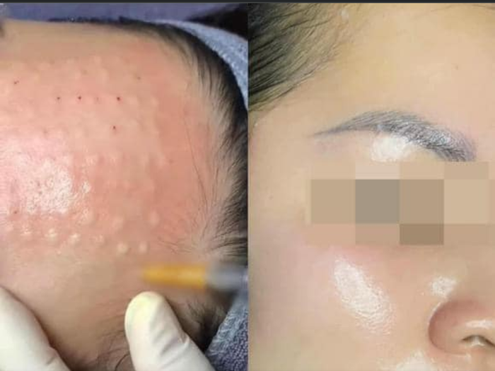 Hình ảnh quy trình điều trị da chuyên nghiệp tại Ellen Beauty & Spa