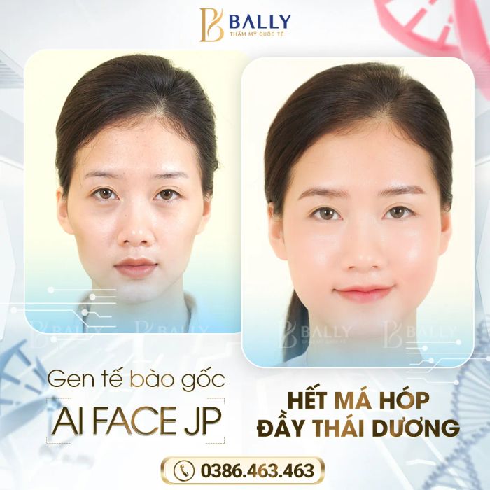 Hình ảnh thực tế về công nghệ hiện đại tại Thẩm mỹ Quốc tế Bally