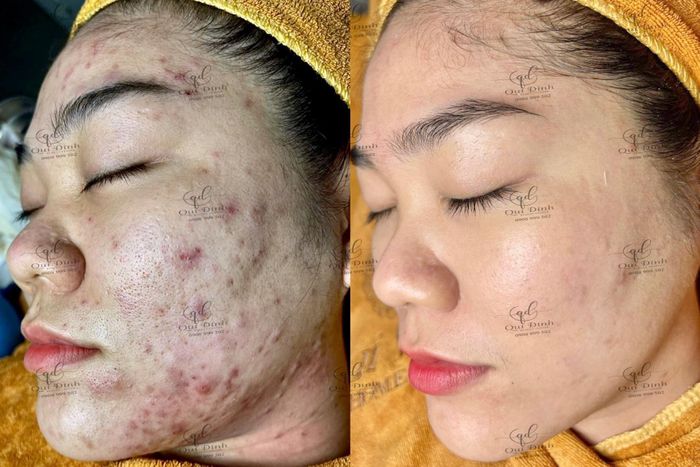 Không gian sang trọng tại Quí Đinh Beauty Center