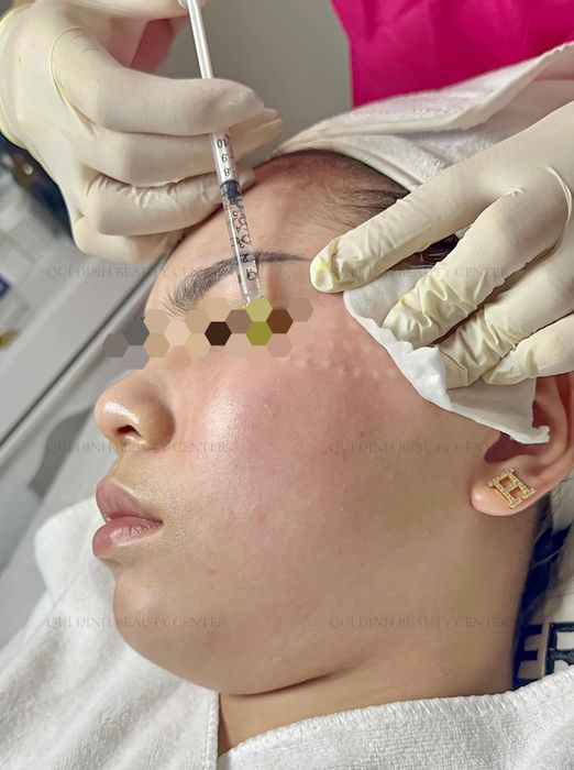 Hình ảnh quy trình điều trị da chuyên nghiệp