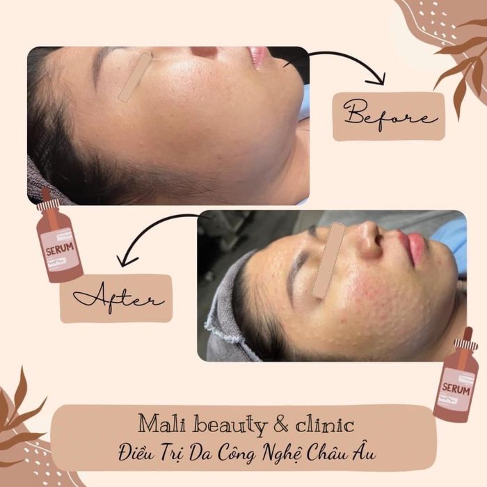 Không gian sang trọng tại MaLi Beauty Spa Clinic