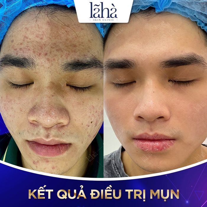 Hình ảnh hệ thống máy móc tân tiến tại Lã Hà Clinic