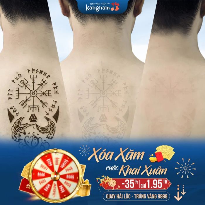 Bệnh viện Thẩm Mỹ Kangnam ảnh 1