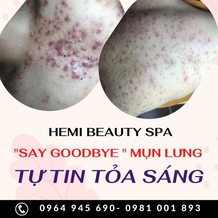 Hình ảnh quy trình trị liệu chuyên nghiệp tại Hemi Spa