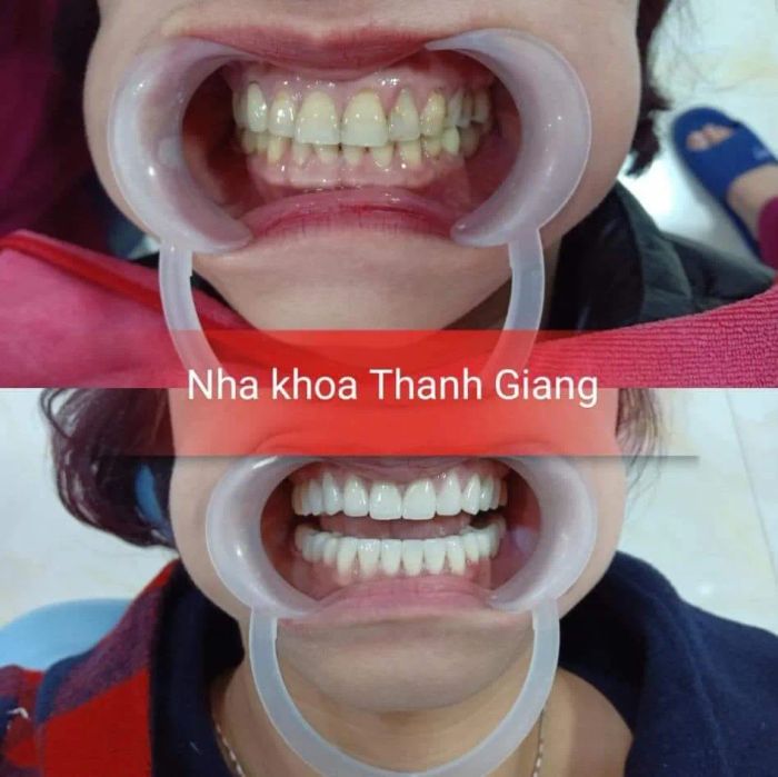 Hình ảnh NHA KHOA THÀNH GIANG - Ảnh 2