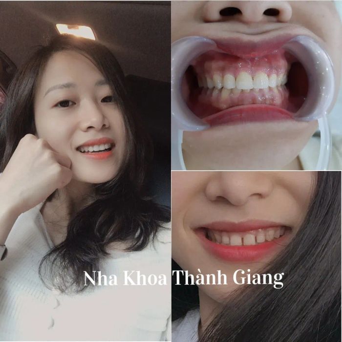 Hình ảnh NHA KHOA THÀNH GIANG - Ảnh 1