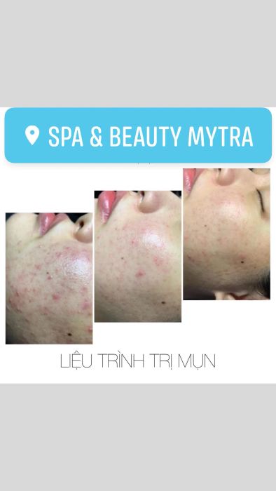 Spa & Beauty MyTra - Hình ảnh 2