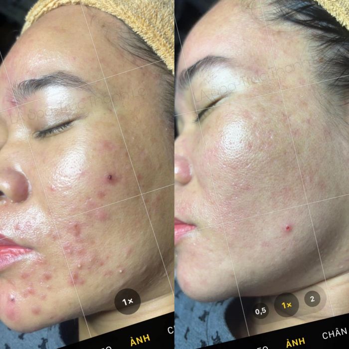 La Spa & Skincare - Hình ảnh 1