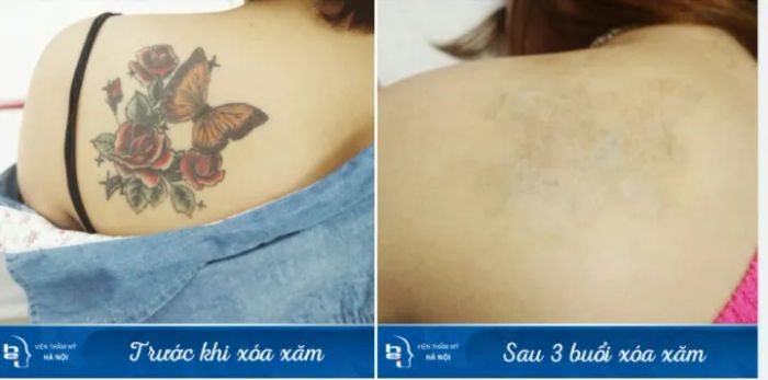 Viện Thẩm Mỹ Hà Nội ảnh 2