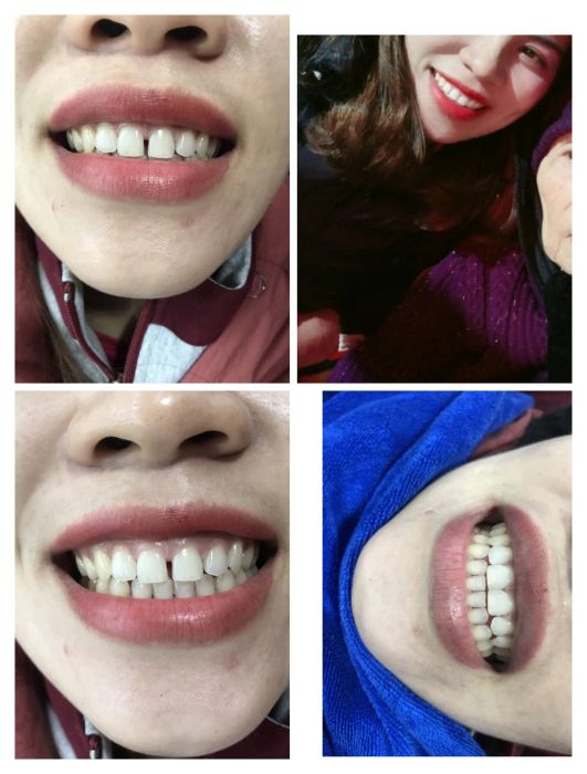 Hình ảnh của Phòng Khám Răng Hàm Mặt Hà Nội
