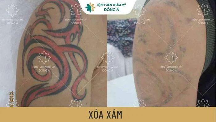 Bệnh Viện Thẩm Mỹ Đông Á ảnh 1