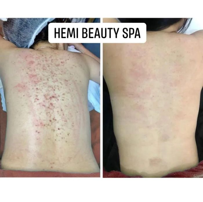 Hình ảnh trị liệu chuyên nghiệp tại 88 Spa