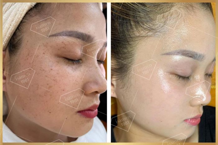 Vy Beauty Spa - Hình ảnh 1