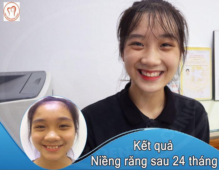 Nha Khoa Tâm Thành Tuyên Quang - Hình ảnh 1