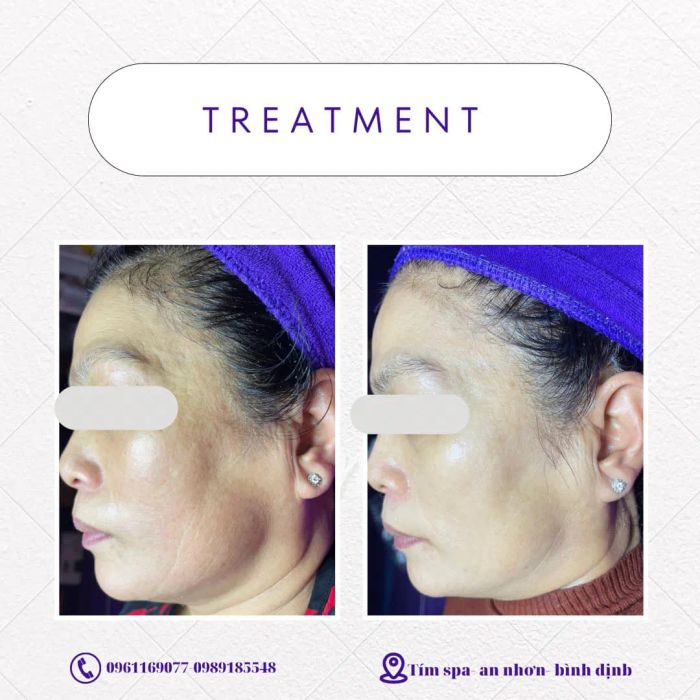 Tím Spa An Nhơn - Hình ảnh 1