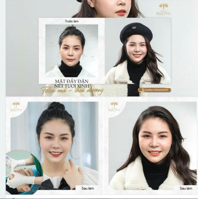 Khám phá không gian sang trọng và tiêu chuẩn vàng tại Thẩm Mỹ Beauty Center By Tấm qua bộ ảnh độc quyền