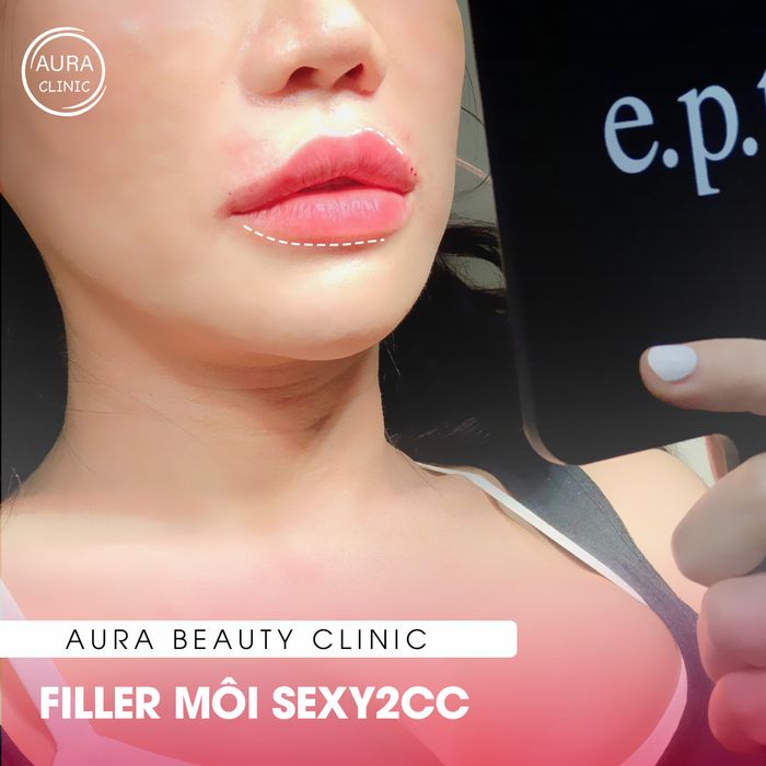 [Bộ sưu tập hình ảnh] Aura Beauty Clinic - ABC - Những kiệt tác thẩm mỹ được kiến tạo từ bàn tay tinh tế
