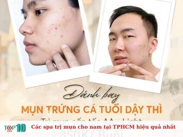Các spa trị mụn hiệu quả cho nam tại TPHCM