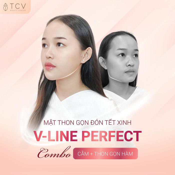 Bộ sưu tập hình ảnh thực tế về quy trình làm đẹp chuyên nghiệp tại Viện Thẩm Mỹ TCV
