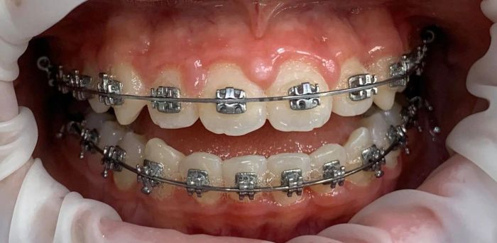 Hình ảnh thực tế tại Nha Khoa Quốc Tế New.Smile